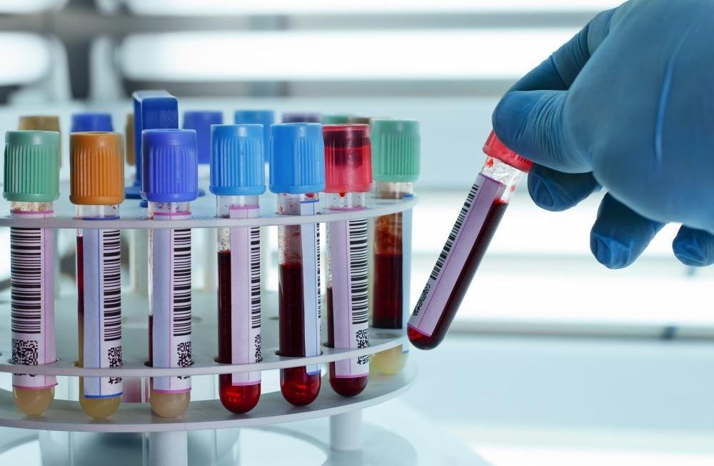 Blood Test