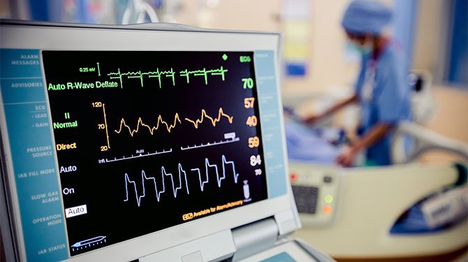 Electrocardiogram
